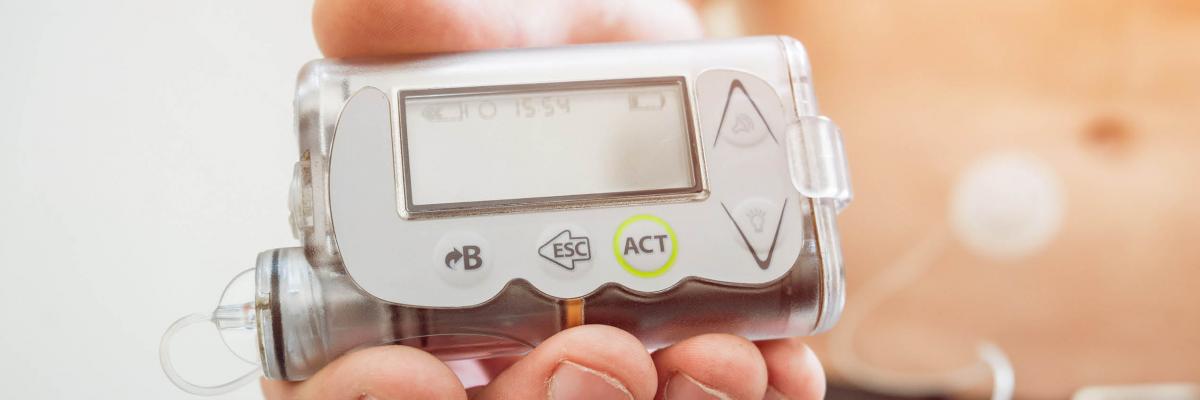 A stock photo of a man with an insulin pump connected to his abdomen, holding the insulin pump in his hands.